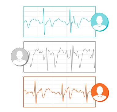 ekg-nymi3