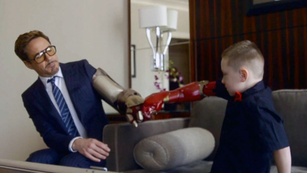 Bionic arm